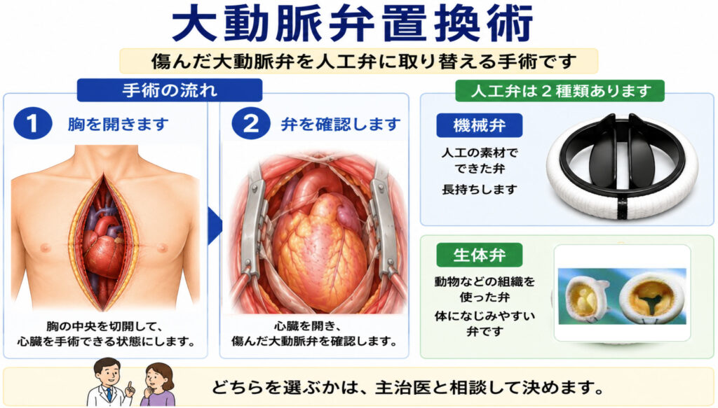 大動脈弁置換術_生体弁写真形状